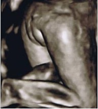 28週。お尻を向けた赤ちゃん。女の子であることが分かります。
※画像はすべて4Dエコーによるものです。