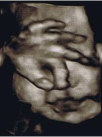 眩しそうに目の前に手をかざす、33週の赤ちゃん。