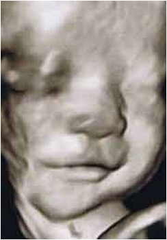 35週。微笑しています。
※画像はすべて4Dエコーによるものです。